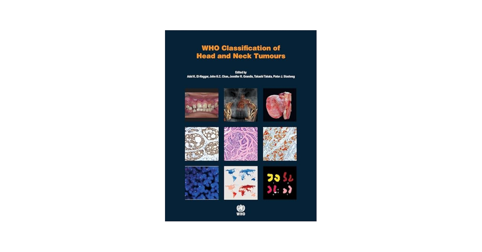 語学+参考書 Pathology And Genetics of Head and Neck Tumours (World Health Organization Classification of Tumours) IARC Publications Website - WHO Classification of Head and